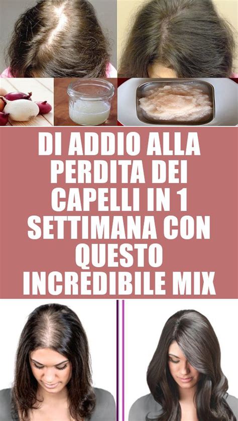 L INCREDIBILE MIX PER COMBATTERE LA CADUTA DEI CAPELLI Perdita Dei