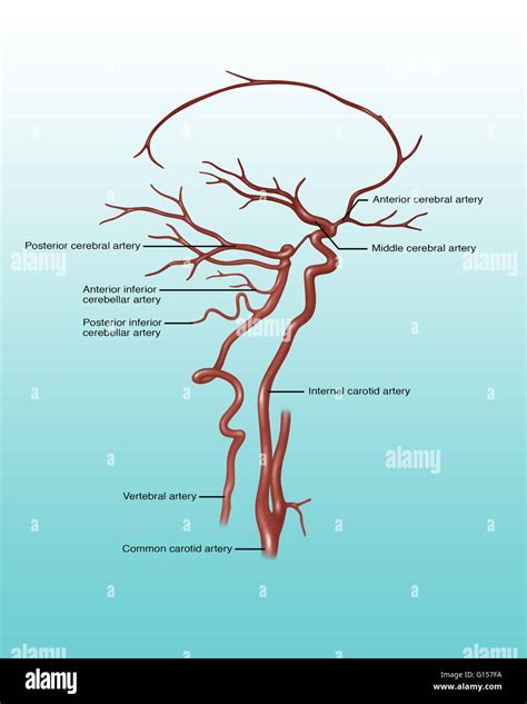 Middle Cerebral Artery Hi Res Stock Photography And Images Alamy