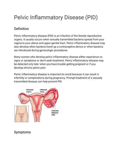 Pelvic Inflammatory Disease Pid Pelvic Inflammatory Off