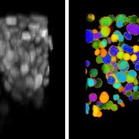 Reconstruction Challenges Of Histological Serial Sections From Light