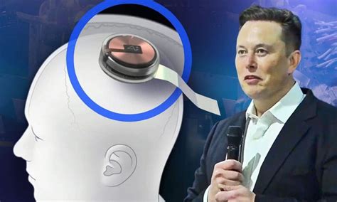 Elon Musk și Neuralink au primit aprobarea de a testa cipurile