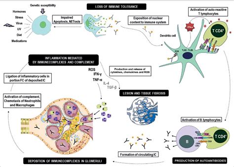 Pdf Pediatric Lupus Nephritis Semantic Scholar