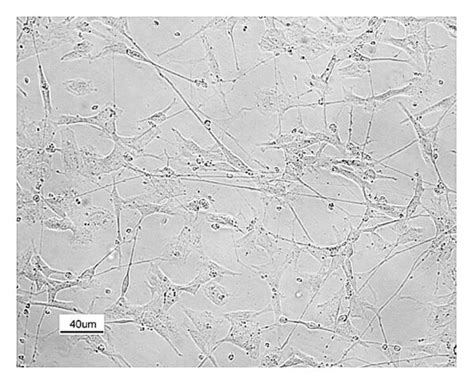 Differentiation of SH-SY5Y cells into a neuronal phenotype. SH-SY5Y ...