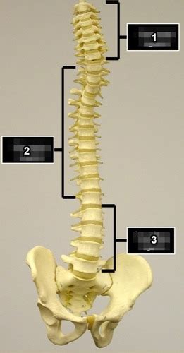 Lab Exercise Axial Skeleton Bones And Markings Vertebral Column