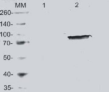 Detection By Western Blot Of The Cry Ia Protein Expressed In E Coli