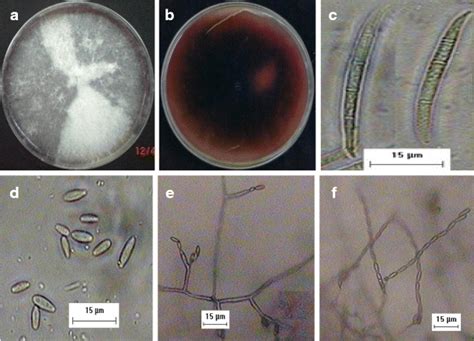 Fusarium Fujikuroi Causing Fusariosis Of Pineapple In Peninsular