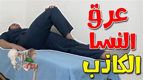 تمرين واحد لعلاج عرق النسا الكاذب Piriformis Syndrome Youtube