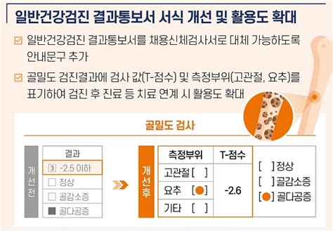 골대사학회 골다공증 고위험군 5070 女 “골다공증 위험하지만 내 뼈 수치는 몰라” 데일리메디팜