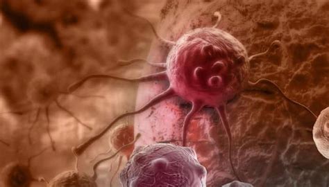 Immunotherapy treatments may better treat skin cancer, says study ...