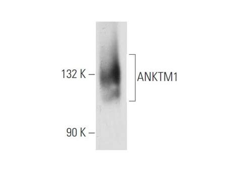 ANKTM1抗体 C 4 SCBT Santa Cruz Biotechnology