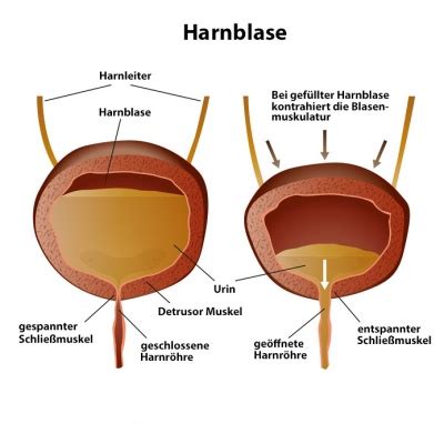 Blasenentz Ndung Ursachen Symptome Behandlung Medlexi De