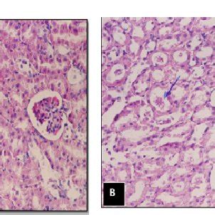 Control animals. A: showing the normal histology of renal parenchyma ...