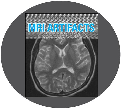 The Importance Of Reading Artifacts In Mri