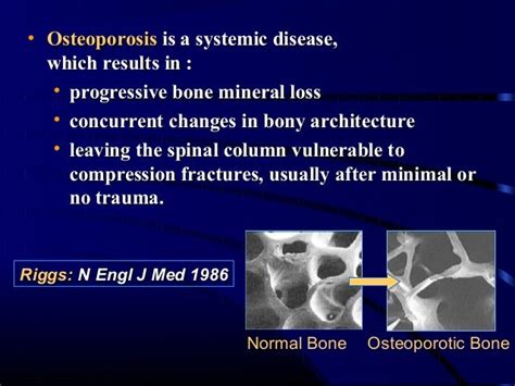 Operative Treatment Osteoporotic Fractures