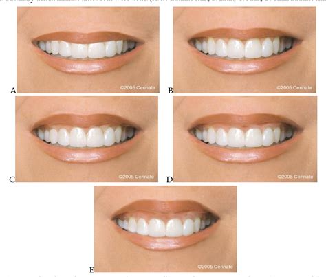 Figure 2 From Comparison Of Perceptions Of Laypersons Dentists And Orthodontists To Altered