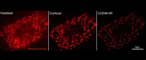 让细胞观测活起来LiveCodim模块化超分辨共聚焦显微镜全新来袭 知乎