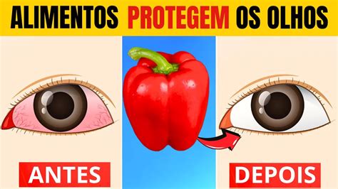 Alimentos Que Protegem Os Olhos E Reparam A Vis O Antiglaucoma