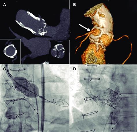 A Multiplanar Reconstructed Computed Tomography Images Showing The Download Scientific Diagram