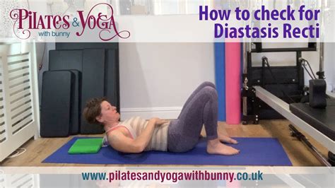 How To Check For Diastasis Recti Youtube