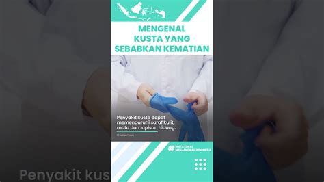 Apa Itu Kusta Penyakit Yang Bisa Picu Kelumpuhan Hingga Kematian