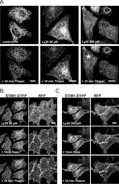 Translocation Of STIM1 EYFP Is Inhibited By The Depletion Of Multiple