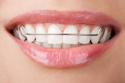 Functional Appliances Shrewsbury Orthodontics Monmouth County NJ