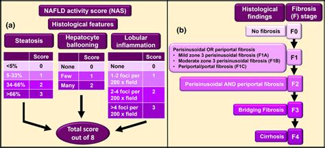 Nafld Activity Score Nas And Staging Of Fibrosis In Nafld A Download Scientific Diagram