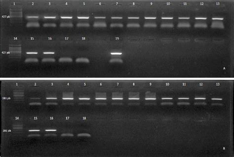 Electroforesis En Gel De Agarosa Al 2 De Los Productos Obtenidos