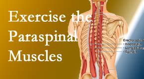 Paraspinal Muscles Matter! | Minster Chiropractic Center