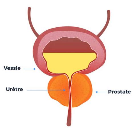 Résection Endoscopique De La Prostate Pour Traiter Lhbp