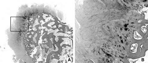 Low Power A H E Stain ×40 And High Power Histologic Examinations