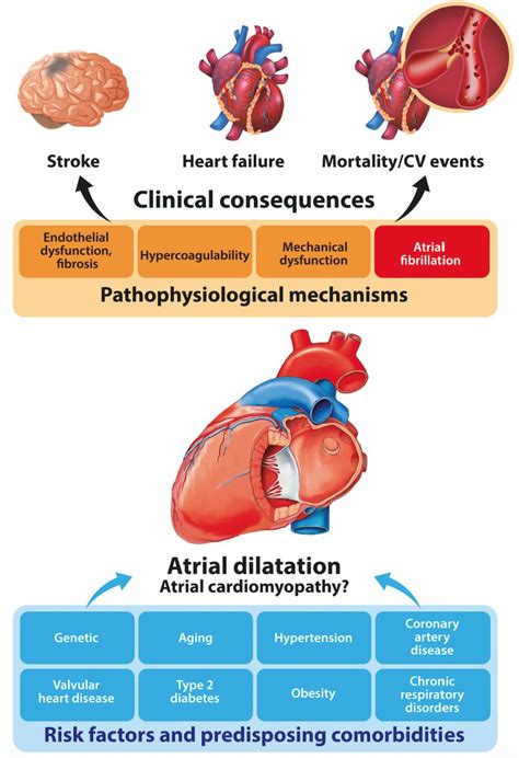 Is Left Atrium The Best Kept Secret Of The Heart Left Atrial