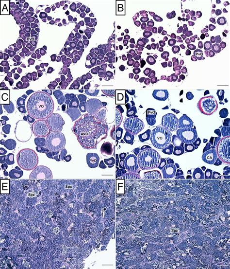 Histological Stages Of Gonadal Development Observed In Spotty Wrasses