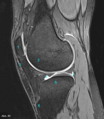 Schnittbildanatomie Knie Sag Diagram Quizlet