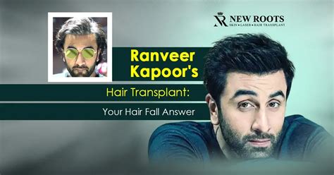 Ranbir Kapoor Hair Transplant Journey: Unbelievable Results