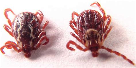 Rocky Mountain spotted fever causes, symptoms, rash and treatment