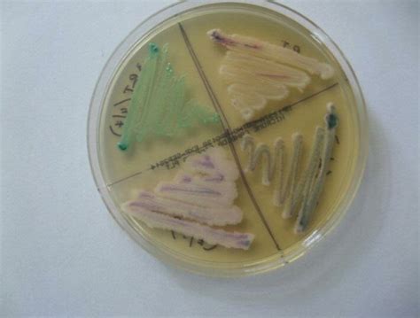 Chrom Agar Showing Coloured Colonies Of Candida Species Antifungal