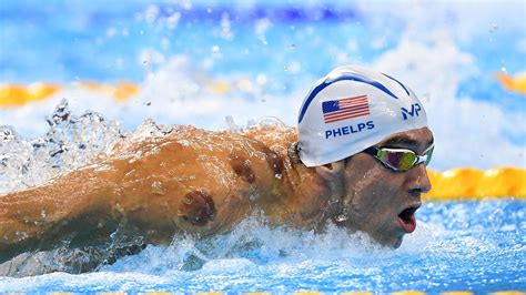 What is Cupping? Inside Michael Phelps’s Olympics Treatment | Vogue