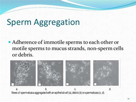 Semen Analysis Powerpoint