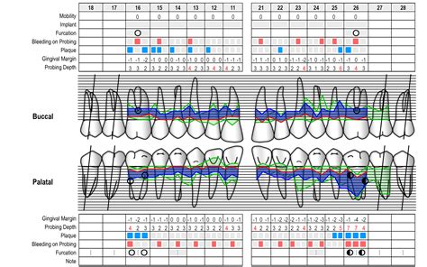 Periodontal Chart Online Perio