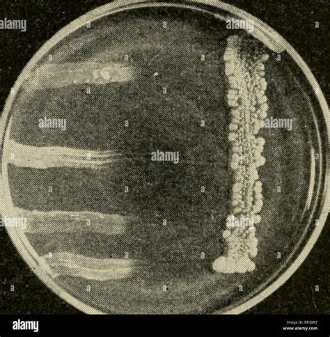 Actinomycetes Hi Res Stock Photography And Images Alamy