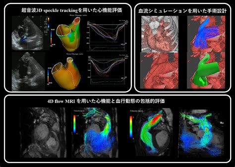 成人先天性心疾患センター 診療科・中央部門紹介 名古屋市立大学病院