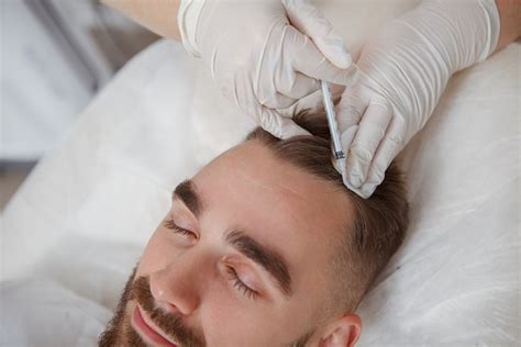 Best Hair Transplant Clinics And Surgeons In Florida Cibo Clinic