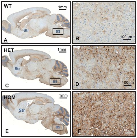 Images Show The Results Of Gfap Immunohistochemistry On Sagittal Brain