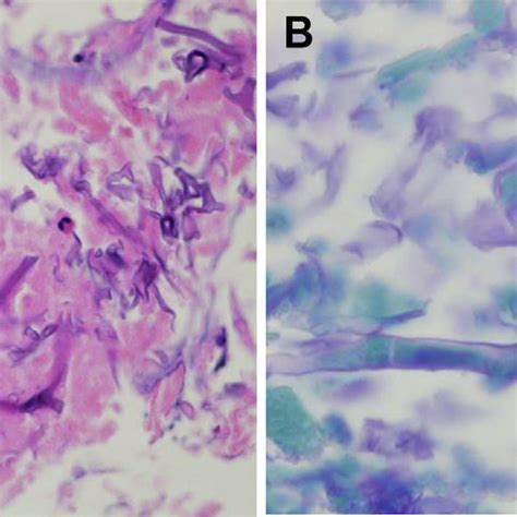 Felson S Classification Of Mediastinum In Anterior Middle And Download Scientific Diagram