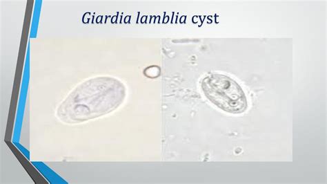 Giardia Ova