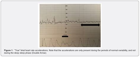 Accelerations Fhr