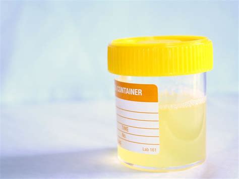 Urine Culture How The Test Works