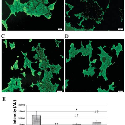 Apoptosis Of Huh7 Cells Observed With A Transmission Electron Download Scientific Diagram