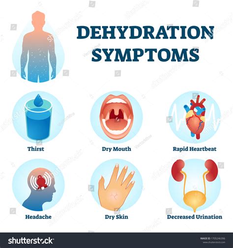 1,250 Dehydration graphic Images, Stock Photos & Vectors | Shutterstock